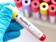 Hepatitis C: Argentina reporta entre 700 y 800 nuevos casos anuales