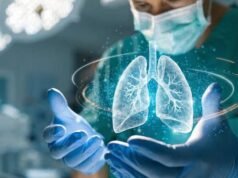 Nódulo pulmonar: claves para identificar si es benigno o maligno